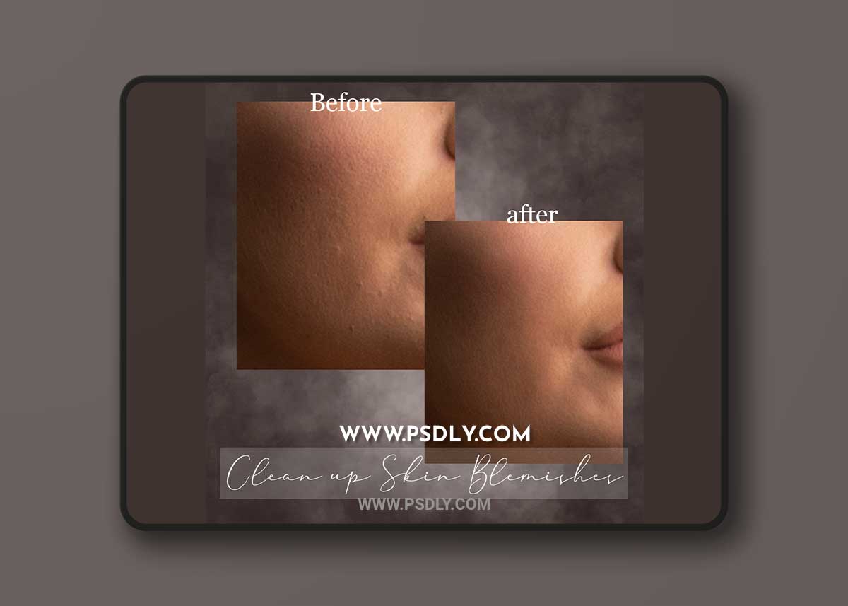 Sweet Soul Studio: Clean up Skin Blemishes Atn 1 Sweet Soul Studio: Clean up Skin Blemishes Atn