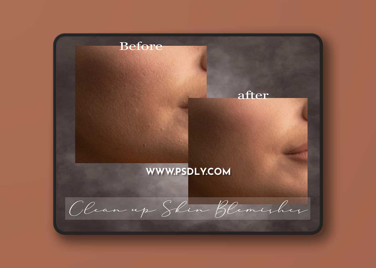 Sweet Soul Studio - Clean up Skin Blemishes 1 Sweet Soul Studio - Clean up Skin Blemishes