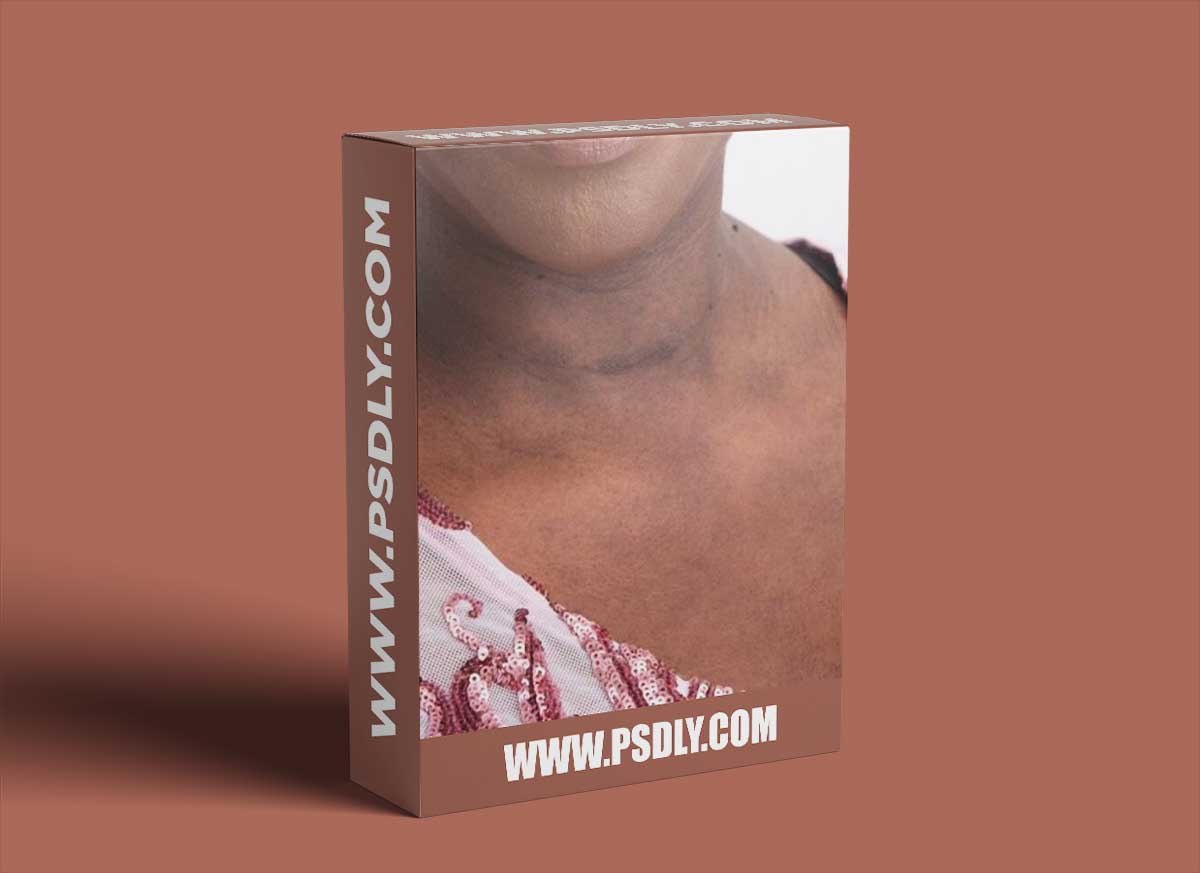 The Portrait Masters - The Retouching Series: Blotchy Skin 1 The Portrait Masters - The Retouching Series: Blotchy Skin