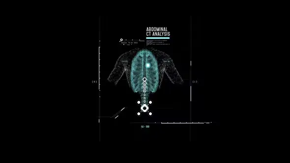 Videohive HUD Abdominal Analysis 44395348 1 Videohive HUD Abdominal Analysis 44395348