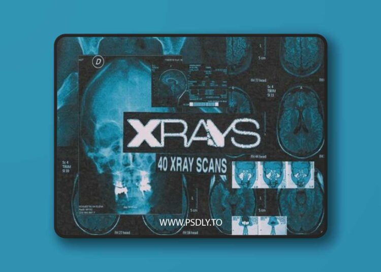 CreativeMarket - X-Rays Image Pack 12698205 1 X-Rays Image Pack 12698205